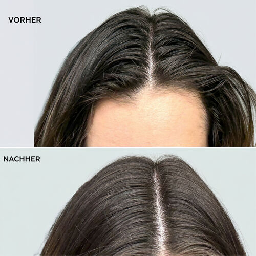 Insta-Wow Fortschrittliches Trockenshampoo - Shampoo & Conditioner | L'Or&eacute;al Partner Shop
